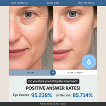 Load image into Gallery viewer, Serumkind Deep Antarctic Serum 30ml