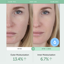 Load image into Gallery viewer, Serumkind Iceland Moss Serum 30ml