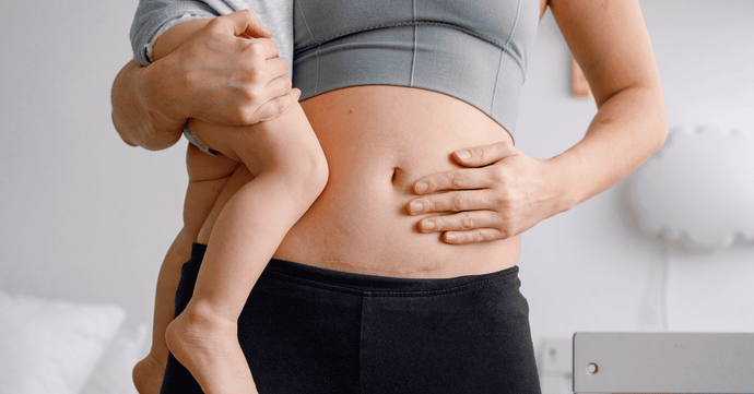 Caesarean section recovery: everything you need to know!