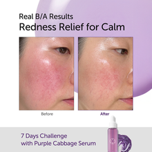 Load image into Gallery viewer, Serumkind Purple Cabbage Serum 30ml
