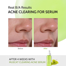 Load image into Gallery viewer, Serumkind Muscat Clearing Serum 30ml
