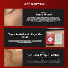 Load image into Gallery viewer, Pimple Lab Invisible Hydrocolloid Spot Patch / Pimple Patch (110 Patches)

